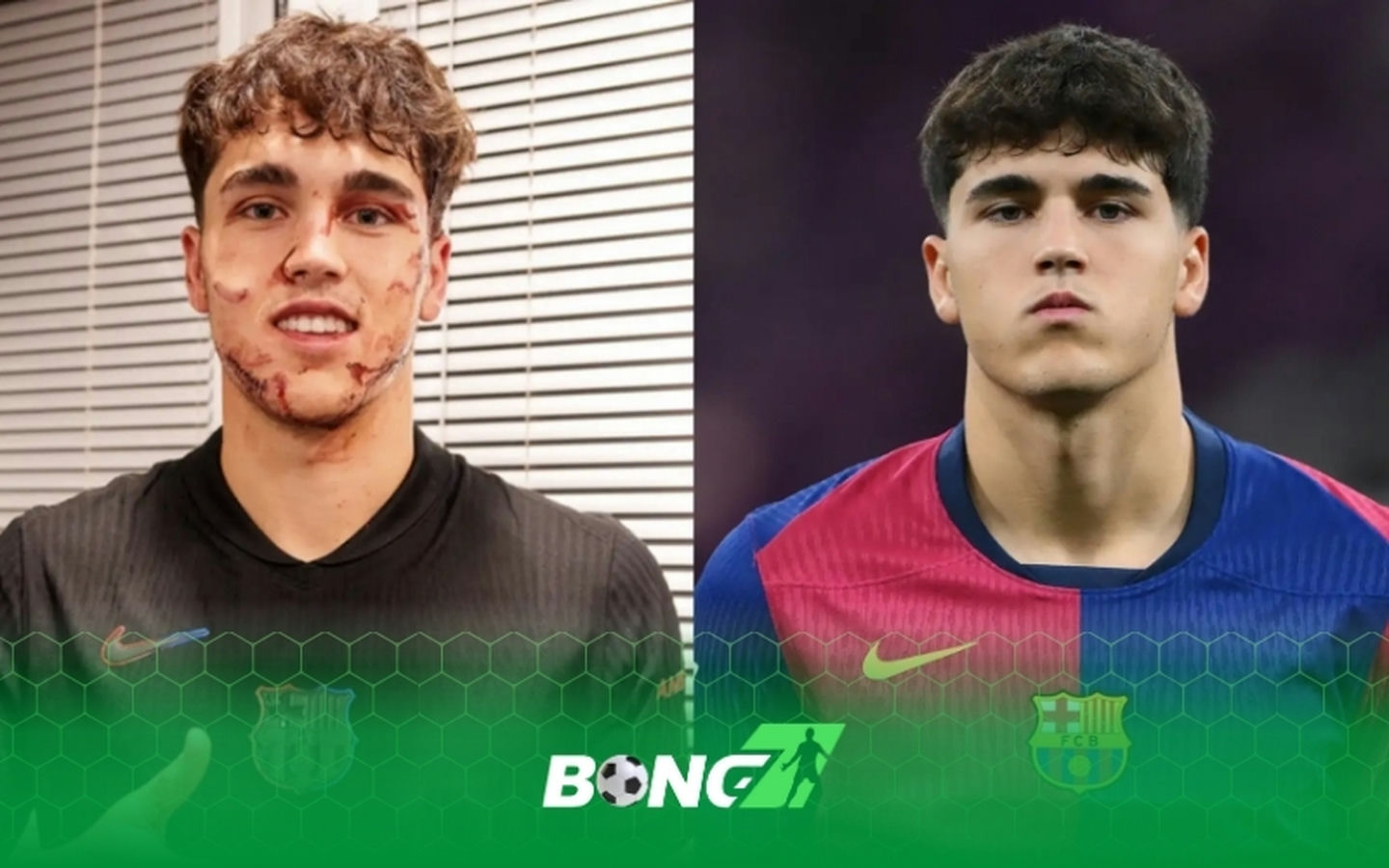 Chấn thương của Pau Cubarsi khiến Barca đứng ngồi không yên